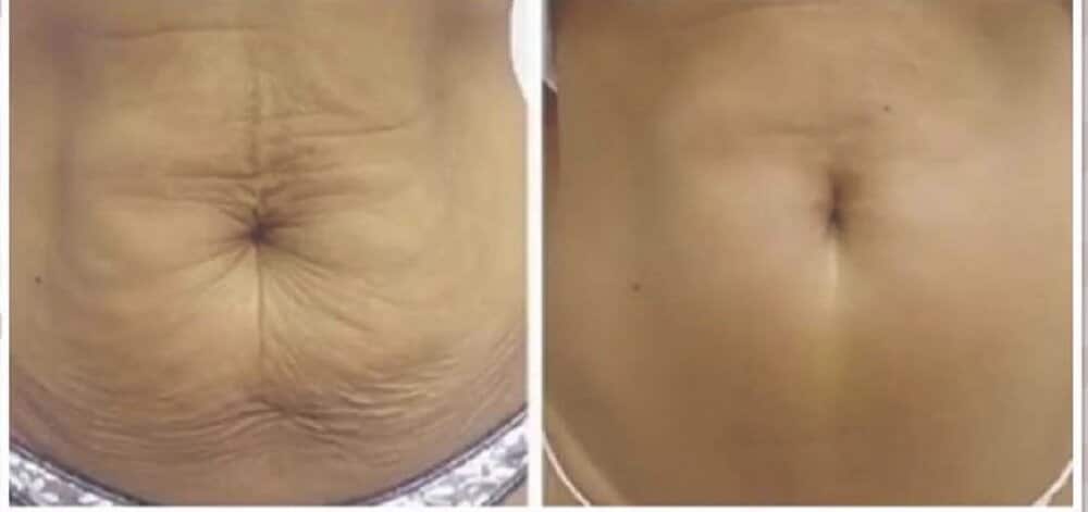 belly2