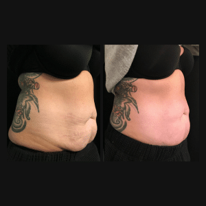 body contour 6