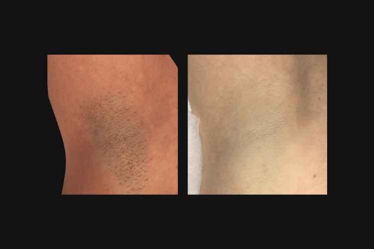 BEFORE & AFTER PHOTOS (750 x 500 px) (1)