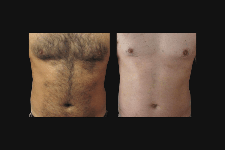 BEFORE & AFTER PHOTOS (750 x 500 px) (2)