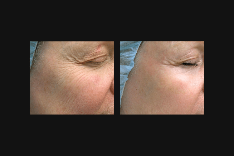 BEFORE & AFTER PHOTOS (750 x 500 px) (3)