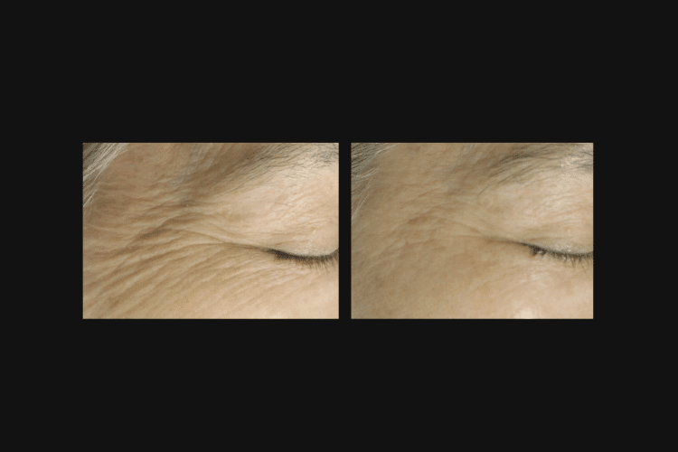 BEFORE & AFTER PHOTOS (750 x 500 px) (5)