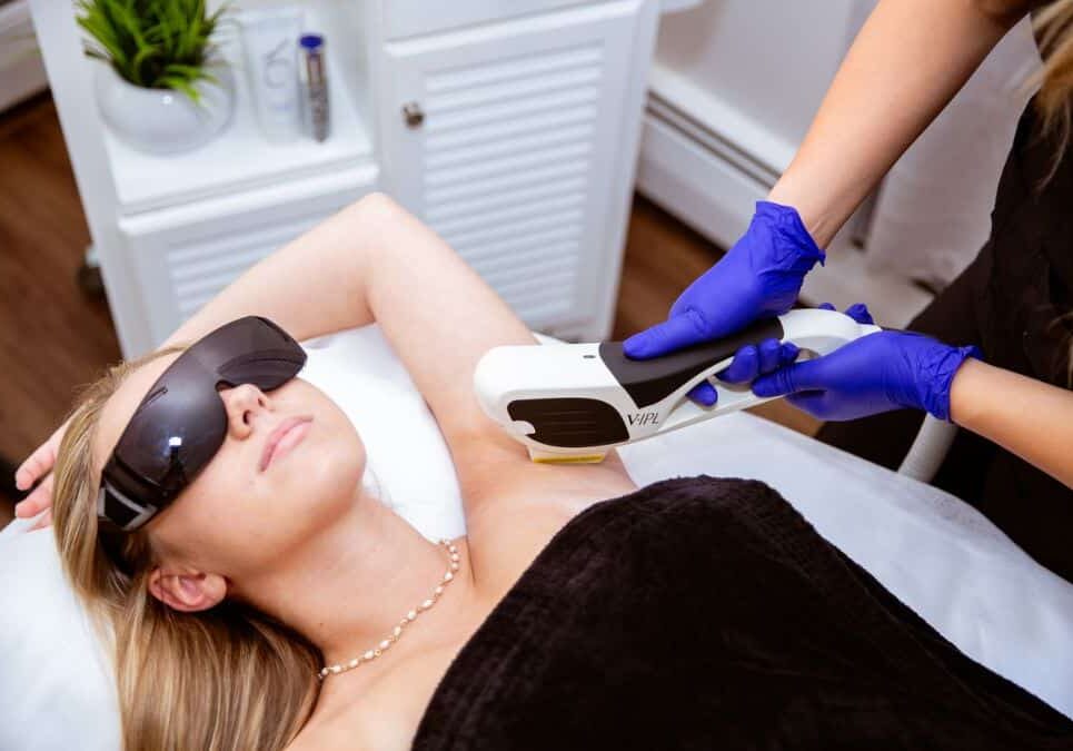 v ipl hair removal