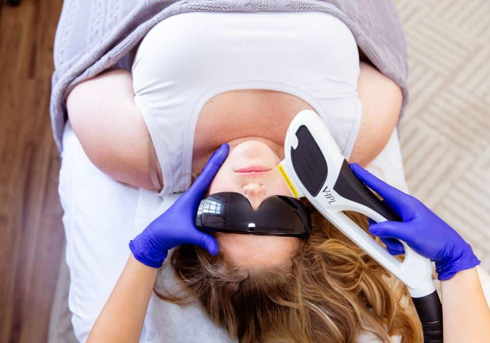 v ipl photo facial